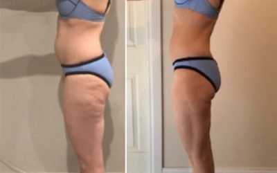 BEFORE & AFTER – 4 week challenge